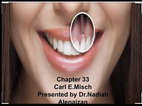 Chapter 33 (mish )