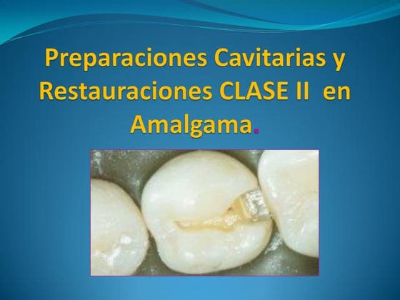 Clase ii  en amalgama uasd 2010  1 restauradora