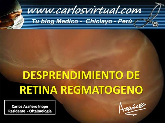 DESPRENDIMIENTO DE RETINA REGMATOGENO