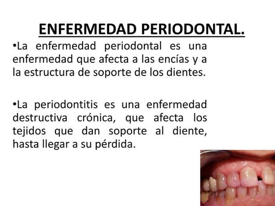ENFERMEDAD_PERIODONTAL.pdf