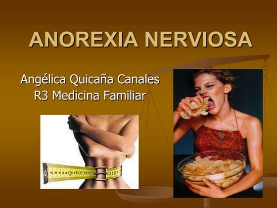 Exposicion final bulimia anorexia