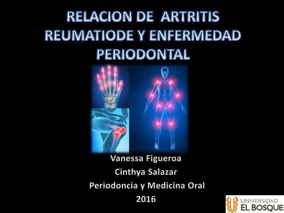 Manejo del paciente con artritis reumatoide