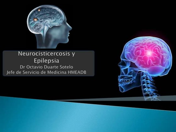 Neurocisticercosis epilesia