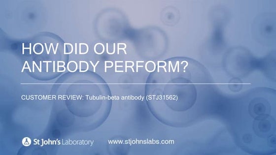 Customer Review For Tubulin-beta Polyclonal Antibody- IF Application (STJ31562)