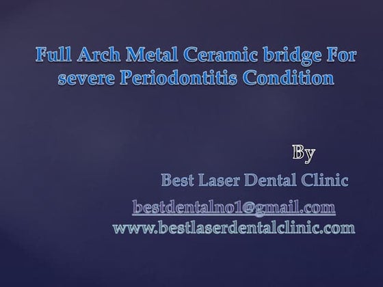 Full Arch Metal Ceramic bridge For severe Periodontitis Condition