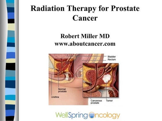 Radiotherapy for Prostate Cancer