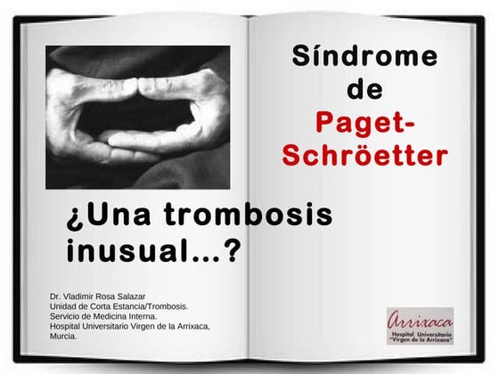 TVP miembro superior: SD. Paget-Schroetter.