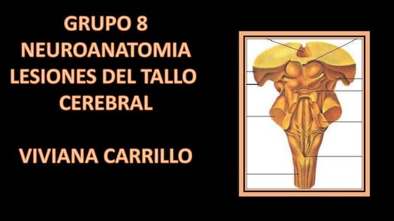 Sindromes de tallo 1 neuroanato