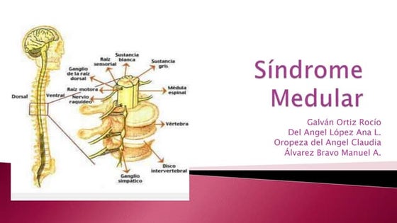 Sindromes medulares 9°d (comp)