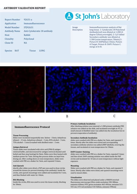 Immunofluorescence Antibody Validation Report for Anti-Cytokeratin 18 Antibod...