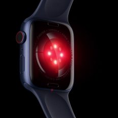 Apple Watch Series 12 rumored redesign with eight-sensor ring layout for improved health tracking and accuracy.