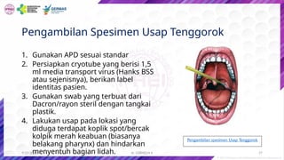dr. CORNELIA K
Pengambilan Spesimen Usap Tenggorok
1. Gunakan APD sesuai standar
2. Persiapkan cryotube yang berisi 1,5
ml media transport virus (Hanks BSS
atau sejenisnya), berikan label
identitas pasien.
3. Gunakan swab yang terbuat dari
Dacron/rayon steril dengan tangkai
plastik.
4. Lakukan usap pada lokasi yang
diduga terdapat koplik spot/bercak
kolpik merah keabuan (biasanya
belakang pharynx) dan hindarkan
menyentuh bagian lidah.
Pengambilan spesimen Usap Tenggorok
9/22/2022 27
 