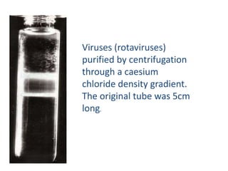 Viruses (rotaviruses)
purified by centrifugation
through a caesium
chloride density gradient.
The original tube was 5cm
long.
 