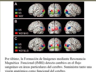 de las Enfermedades del
                SNC
A.-   Geneticamente determinadas       E
                                       P
B.-   Congenitas                       I
C.-   Traumaticas                  C   D
                                   R   E
D.-   Autoinmunes                  I   M
E.-   Metabolicas                  T   I
                                   E
F.-   Paraneoplasicas              R
                                       O
                                       L
G.-   Tumores                      I   O
H.-   Toxicas                      O   G
                                       I
I.-   Vasculares                       C
J.-   Infecciosas                      O
 