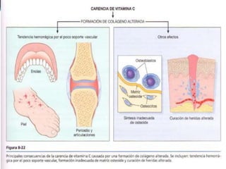 desnutricion-150318204728-conversion-gate01.pptx