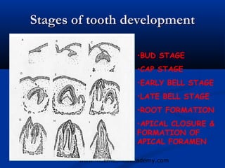 Stages of tooth development

                         •BUD STAGE
                         •CAP STAGE
                         •EARLY BELL STAGE
                         •LATE BELL STAGE
                         •ROOT FORMATION
                         •APICAL CLOSURE &
                         FORMATION OF
                         APICAL FORAMEN

        www.indiandentalacademy.com
 