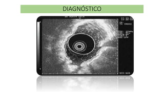 DIAGNÓSTICO
 