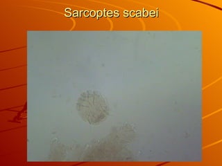 Sarcoptes scabei 
