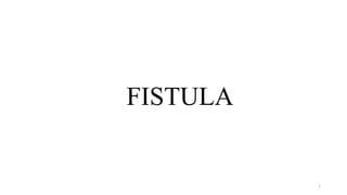 1
FISTULA
 