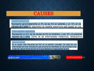 ACTUALIZADO 2013
CAUSES
 