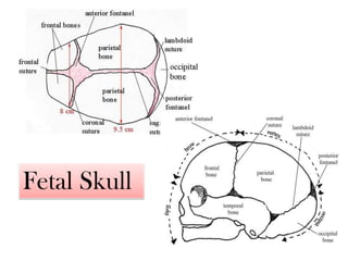 Fetal Skull
 
