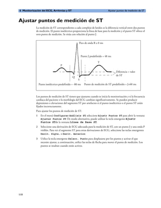 6 Monitorización del ECG, Arritmias y ST                                          Ajustar puntos de medición de ST



Ajustar puntos de medición de ST
            La medición de ST correspondiente a cada complejo de latidos es la diferencia vertical entre dos puntos
            de medición. El punto isoeléctrico proporciona la línea de base para la medición y el punto ST ofrece el
            otro punto de medición. Se sitúa con relación al punto J.


                                                      Pico de onda R a 0 ms



                                                         Punto J predefinido = 48 ms

                                                                        T
                                    P

                                                                                          Diferencia = valor
                                                                                          de ST
                                               Q
                                                     S
                Punto isoeléctrico predefinido = -80 ms     Punto de medición de ST predefinido = J+60 ms



            Los puntos de medición de ST tienen que ajustarse cuando se inicia la monitorización y si la frecuencia
            cardíaca del paciente o la morfología del ECG cambian significativamente. Se pueden producir
            depresiones o elevaciones del segmento ST por artefactos si el punto isoeléctrico o el punto ST están
            fijados incorrectamente.
            Para ajustar los puntos de medición de ST:
            1    En el menú Configurar Análisis ST, seleccione Ajustr Puntos ST para abrir la ventana
                 Ajustar Puntos ST. De modo alternativo, puede utilizar la tecla emergente Ajustr
                 Puntos STde la ventana Línea de Base ST.
            2    Seleccione una derivación de ECG adecuada para la medición de ST, con un punto J y una onda P
                 visibles. Para ver el segmento ST para otras derivaciones de ECG, seleccione las teclas emergentes
                 Deriv. Sigte. o Deriv. Anterior.
            3    Utilice la tecla emergente Selecc. Punto para desplazarse por los puntos y activar el que
                 necesite ajustar, a continuación, utilice las teclas de flecha para mover el punto de medición. Los
                 puntos se resaltan cuando están activos.




110
 
