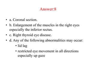 Answer:8
• a. Coronal section.
• b. Enlargement of the muscles in the right eyes
especially the inferior rectus.
• c. Right thyroid eye disease.
• d. Any of the following abnormalities may occur:
• lid lag
• restricted eye movement in all directions
especially up gaze
 