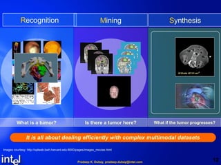 What is a tumor? Is there a tumor here? What if the tumor progresses? It is all about dealing efficiently with complex multimodal datasets R ecognition M ining S ynthesis Images courtesy: http://splweb.bwh.harvard.edu:8000/pages/images_movies.html 