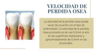 La velocidad de la perdida ósea puede
variar de acuerdo con el tipo de
enfermedad. La velocidad de la perdida
ósea promedio es de casi 0.2mm al año
en las superficies vestibulares y
aproximadamente de 0.3mm en las
proximales.


VELOCIDAD DE
PERDIDA OSEA
 