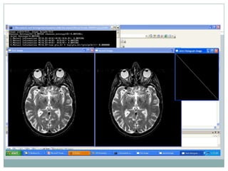 Issues in Image Registration and Image similarity based on mutual information