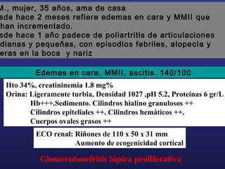 M., mujer, 35 años, ama de casa
sde hace 2 meses refiere edemas en cara y MMII que
han incrementado.
sde hace 1 año padece de poliartritis de articulaciones
dianas y pequeñas, con episodios febriles, alopecía y
eras en la boca y nariz
Edemas en cara, MMII, ascitis. 140/100
Hto 34%, creatininemia 1.8 mg%
Orina: Ligeramente turbia, Densidad 1027 ,pH 5.2, Proteínas 6 gr/L
Hb+++.Sedimento. Cilindros hialino granulosos ++
Cilindros epiteliales ++. Cilindros hemáticos ++.
Cuerpos ovales grasos ++
ECO renal: Riñones de 110 x 50 x 31 mm
Aumento de ecogenicidad cortical

Glomerulonefritis lúpica proliferativa

 