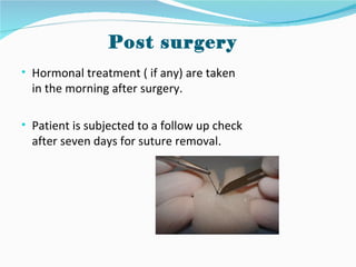 Post surgery
• Hormonal treatment ( if any) are taken
  in the morning after surgery.

• Patient is subjected to a follow up check
  after seven days for suture removal.
 