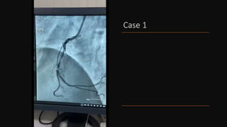 Case 1
 